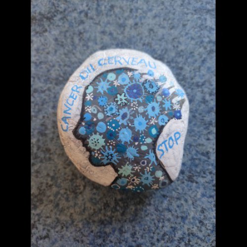 Pens�es pour Myl�ne Cancer du cerveau stop