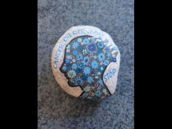 Pens�es pour Myl�ne Cancer du cerveau stop